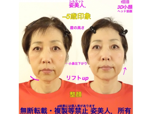 小顔矯正+美骨筋膜リリース全身矯正 姿美人.(シルエット)
