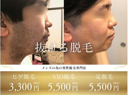 メンズ脱毛サロンDugong【ジュゴン】市川本八幡店