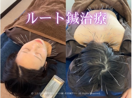 三上はり灸接骨院内 ルート鍼・美容鍼サロン