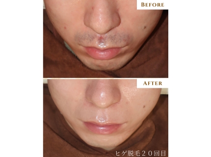 シミケア＆肌改善専門メディカルエステサロングレース