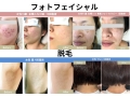 SHINE Beauty Salon【脱毛・ホワイトニング・整体・フェイシャル】