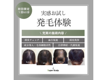 薄毛治療・AGA治療専門スーパースカルプ発毛センター岡山駅前店